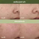 Thumbnail 3 of ออริจินส์ น้ำตบเห็ด Mega-Mushroom Relief & Resilience Soothing Treatment Lotion 200 มล.