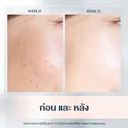 Thumbnail 4 of ยูเซอริน โฟมหน้า Spotless Brightening Gentle Cleansing Foam 150 ก.