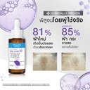 Thumbnail 5 of มิซึมิ แอดวานซ์ นีโอ-ทีเอ็กซ์บีทรี คอนเซนเทรท เซรั่ม - 30 มล.